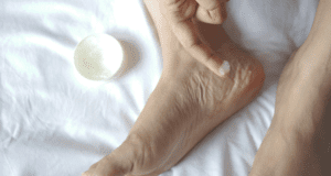 Woman adding petroleum jelly to her feet before a hike to prevent blisters