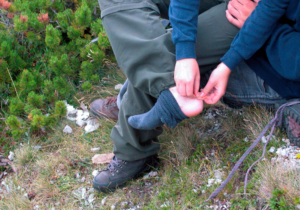 hiker treating his blisters while on the trail